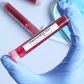 Coronavirus, dodici nuovi casi in Puglia, sei in provincia di Bari