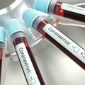 Coronavirus, 917 casi positivi in Puglia su meno di 3mila tamponi
