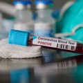 Coronavirus, in Puglia 120 nuovi casi positivi di cui 27 nel barese