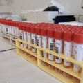 Covid, 44 nuovi casi in Puglia su 6mila tamponi analizzati