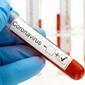 Coronavirus, 140 nuovi casi in Puglia. Nessun decesso nel barese