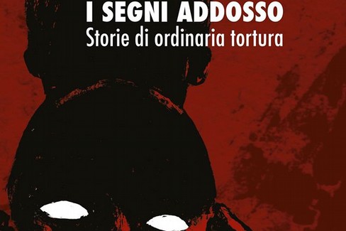 mostra i segni addosso